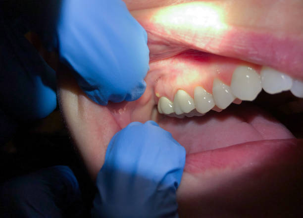 Best Emergency Treatment for Jaw Pain or Injury in Princeton, WI