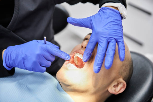 Best Knocked-Out Tooth (Avulsed Tooth) Treatment in Princeton, WI
